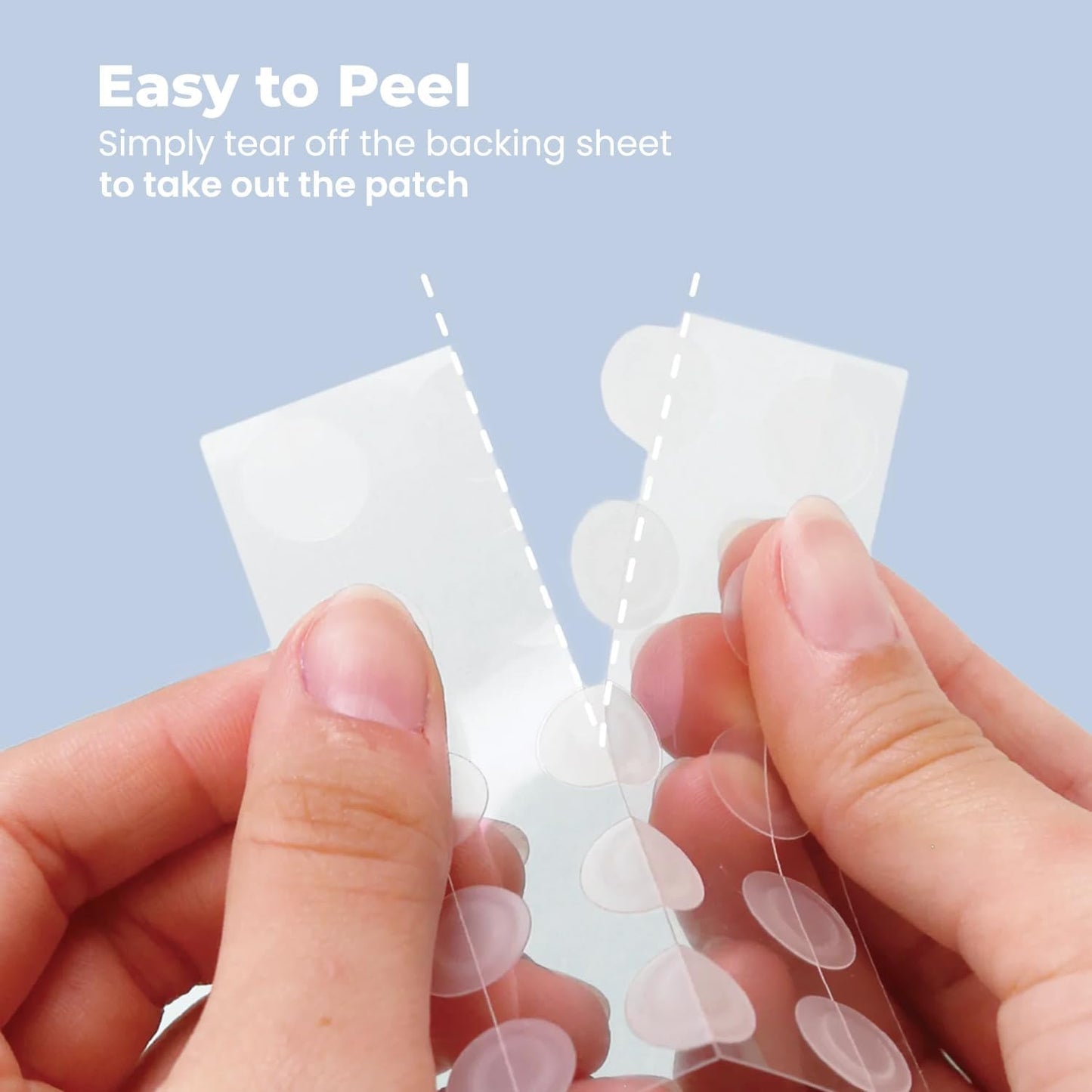 ROSELYNBOUTIQUE Pimple Patches - Hydrocolloid Spot Patches for Blemishes – 300 Clear Dots – Vegan & Cruelty-Free – Cosmetic Facial Skincare Product