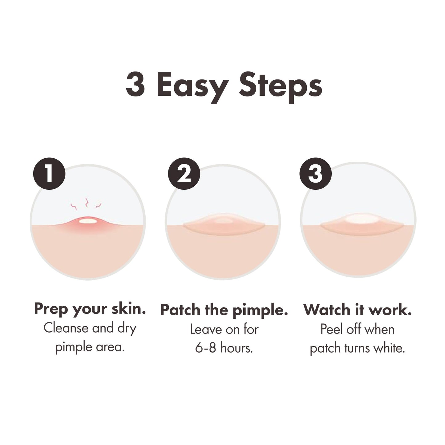 Mighty Patch Original Spot Patches by Hero Cosmetics, Day & Night Time Acne Treatment, Clear Spot Remover Hydrocolloid Patches, Anti Acne Dots, Spot Treatment Pimple Stickers - 36 Patches