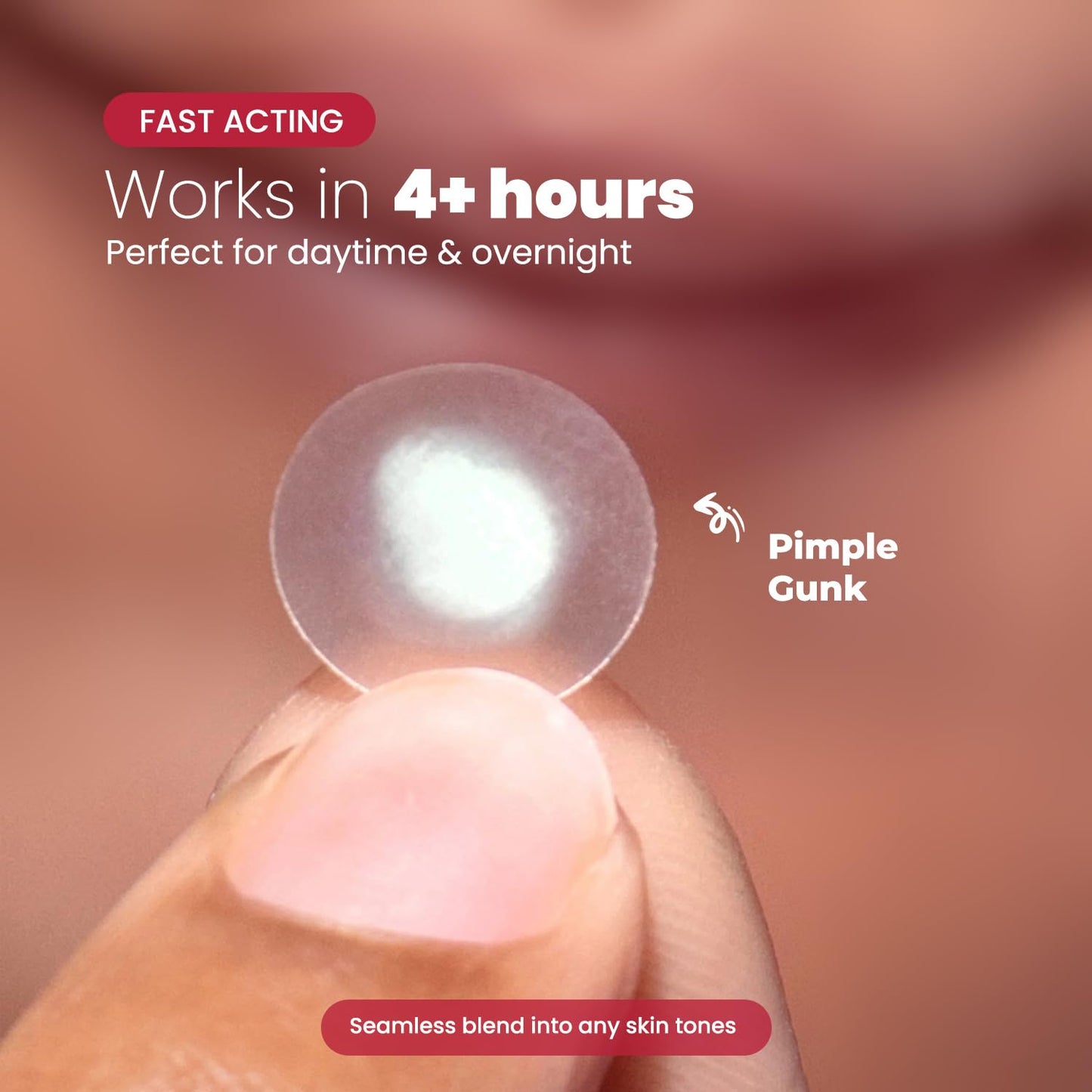 ROSELYNBOUTIQUE Pimple Patches - Hydrocolloid Spot Patches for Blemishes – 300 Clear Dots – Vegan & Cruelty-Free – Cosmetic Facial Skincare Product