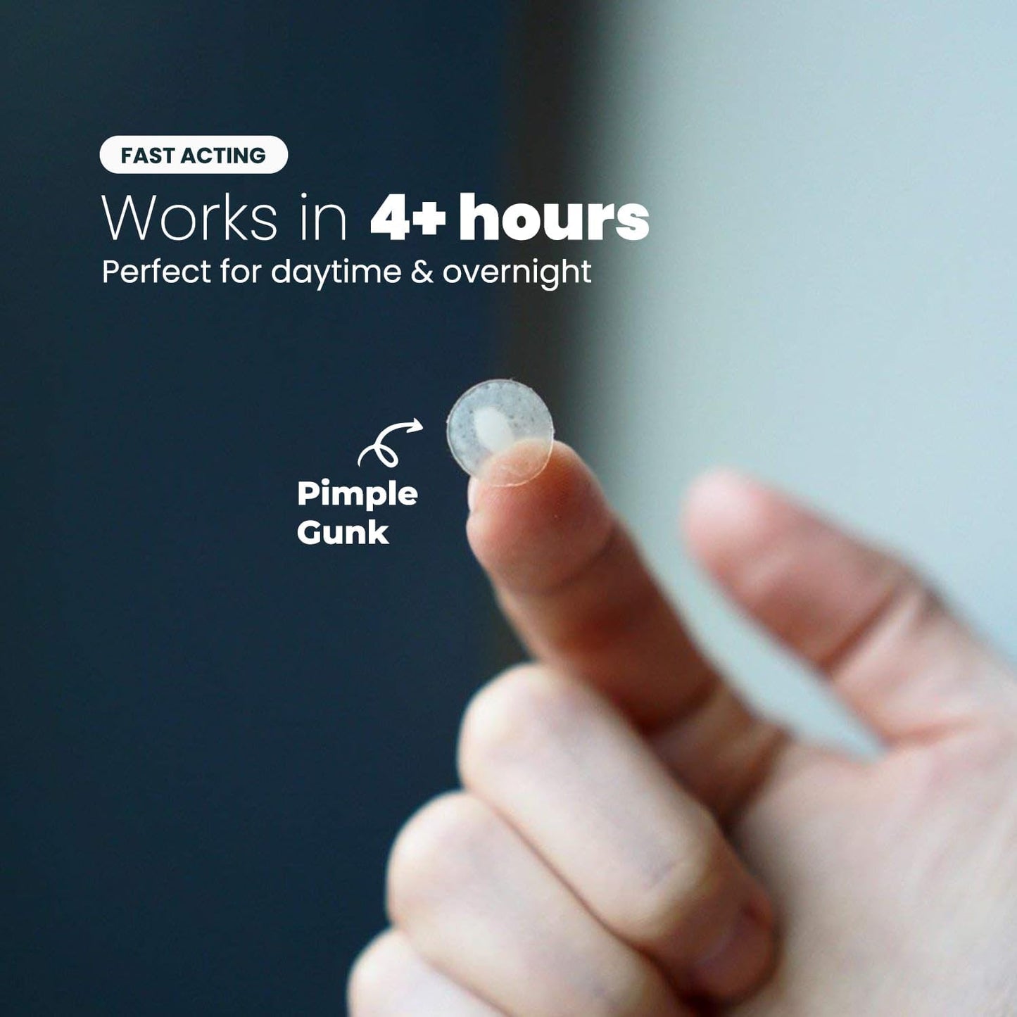 ROSELYNBOUTIQUE Pimple Patches - Hydrocolloid Spot Patches for Blemishes – 300 Clear Dots – Vegan & Cruelty-Free – Cosmetic Facial Skincare Product