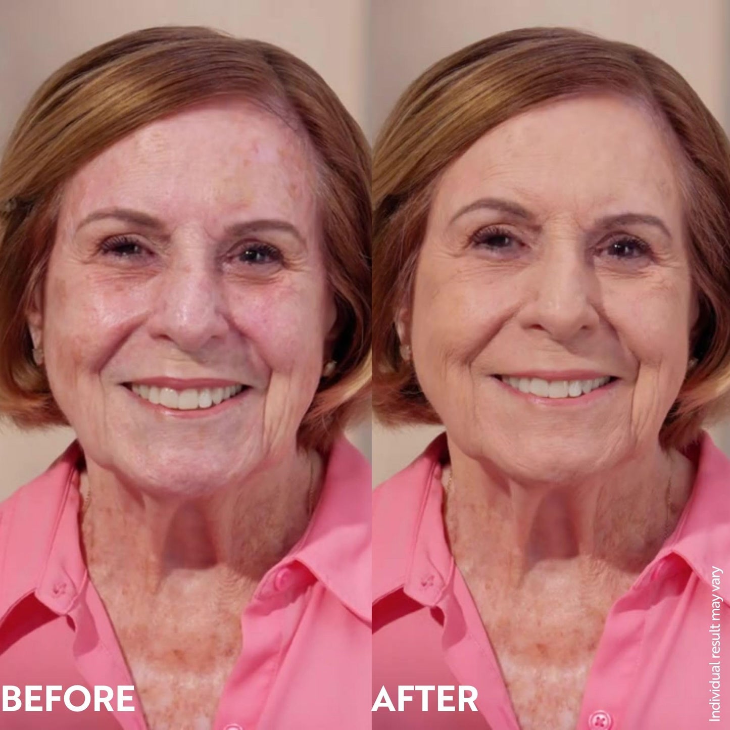 M. Asam Magic Finish Deep Teint Make-Up Mousse (1.01 Fl Oz) – 4in1 Primer, Foundation, Concealer & Powder With Buildable Coverage, Hides Redness And Dark Spots, Vegan, For Deeper Skin Tones