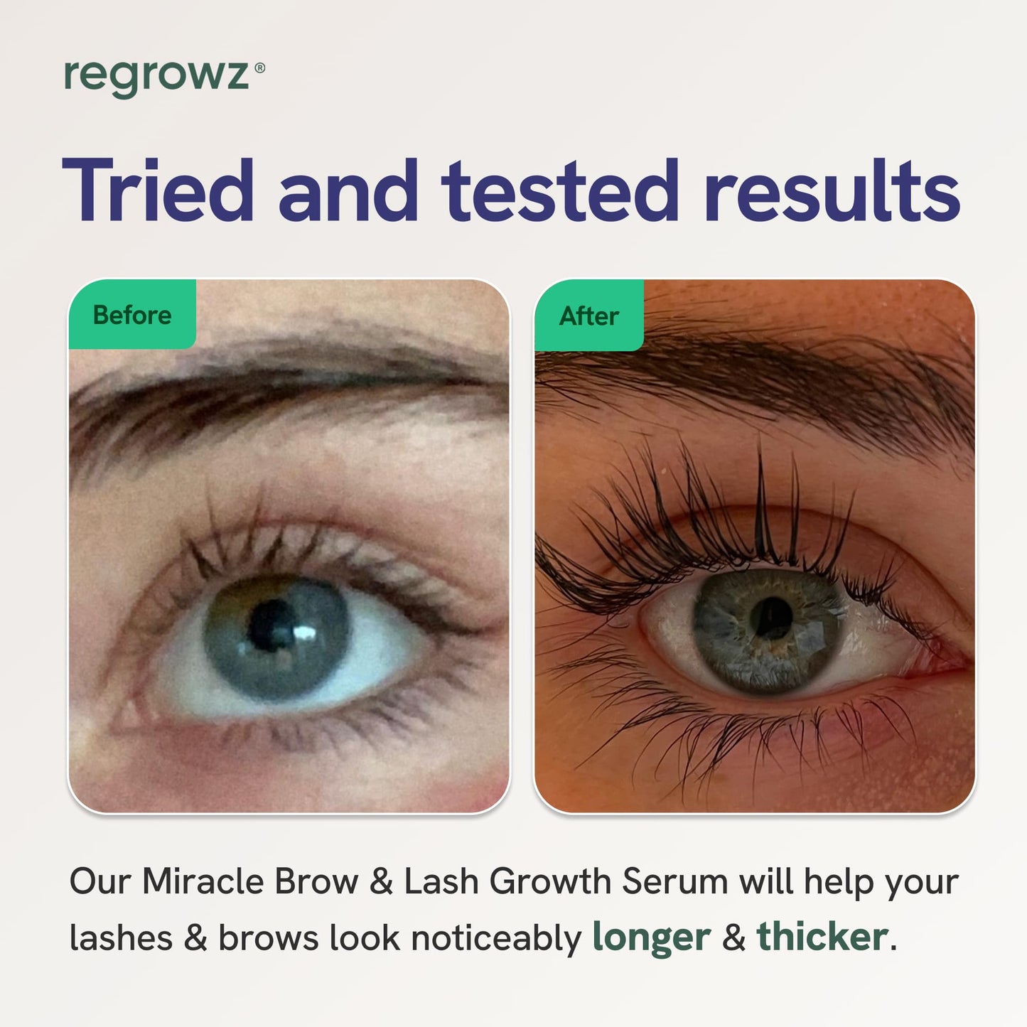 Regrowz Eyelash Serum & Eyebrow Growth 5ml – Natural, Vegan Lash Enhancer for Longer, Thicker Lashes & Fuller Eye Brows – UK Formula with Rapid Results & Conditioning Care For Growth & Thickness