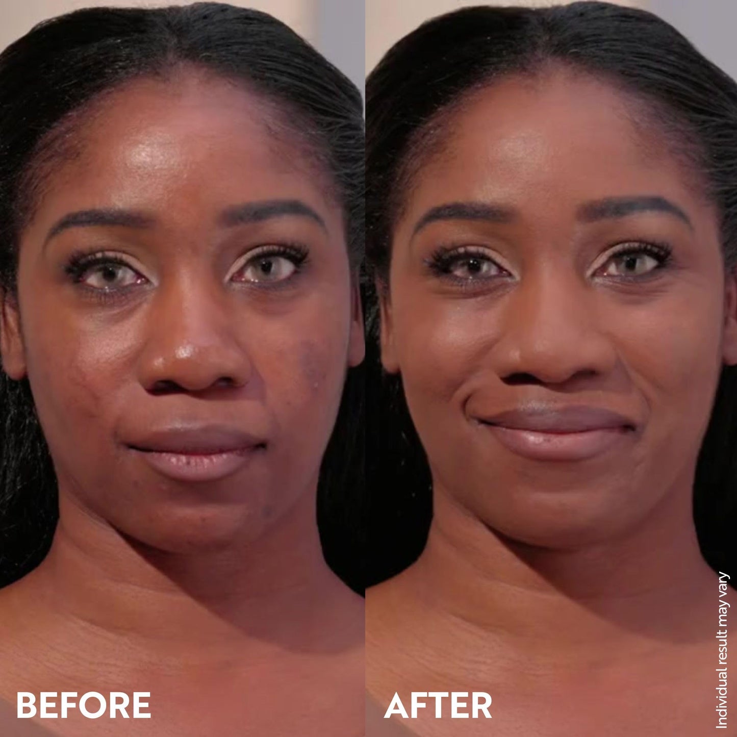 M. Asam Magic Finish Deep Teint Make-Up Mousse (1.01 Fl Oz) – 4in1 Primer, Foundation, Concealer & Powder With Buildable Coverage, Hides Redness And Dark Spots, Vegan, For Deeper Skin Tones