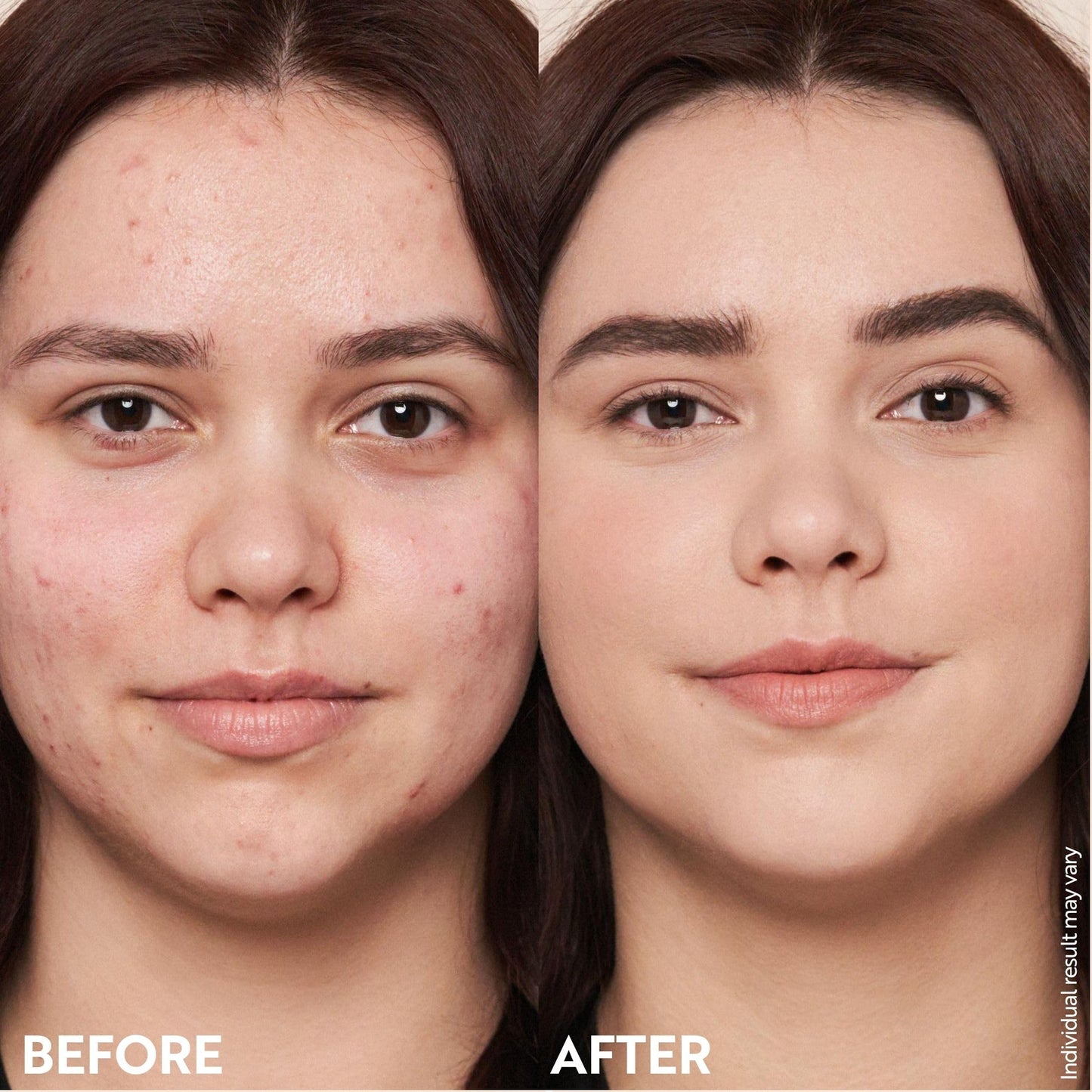 M. Asam Magic Finish Deep Teint Make-Up Mousse (1.01 Fl Oz) – 4in1 Primer, Foundation, Concealer & Powder With Buildable Coverage, Hides Redness And Dark Spots, Vegan, For Deeper Skin Tones