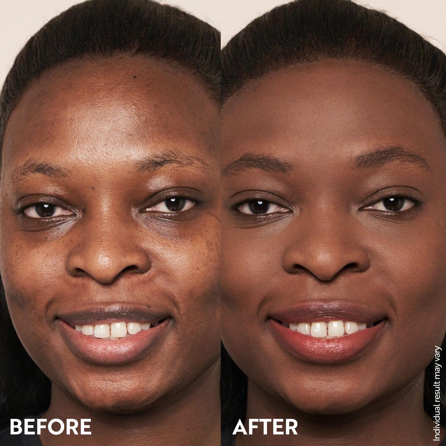 M. Asam Magic Finish Deep Teint Make-Up Mousse (1.01 Fl Oz) – 4in1 Primer, Foundation, Concealer & Powder With Buildable Coverage, Hides Redness And Dark Spots, Vegan, For Deeper Skin Tones