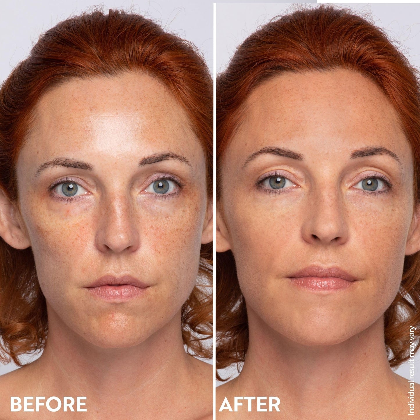 M. Asam Magic Finish Deep Teint Make-Up Mousse (1.01 Fl Oz) – 4in1 Primer, Foundation, Concealer & Powder With Buildable Coverage, Hides Redness And Dark Spots, Vegan, For Deeper Skin Tones