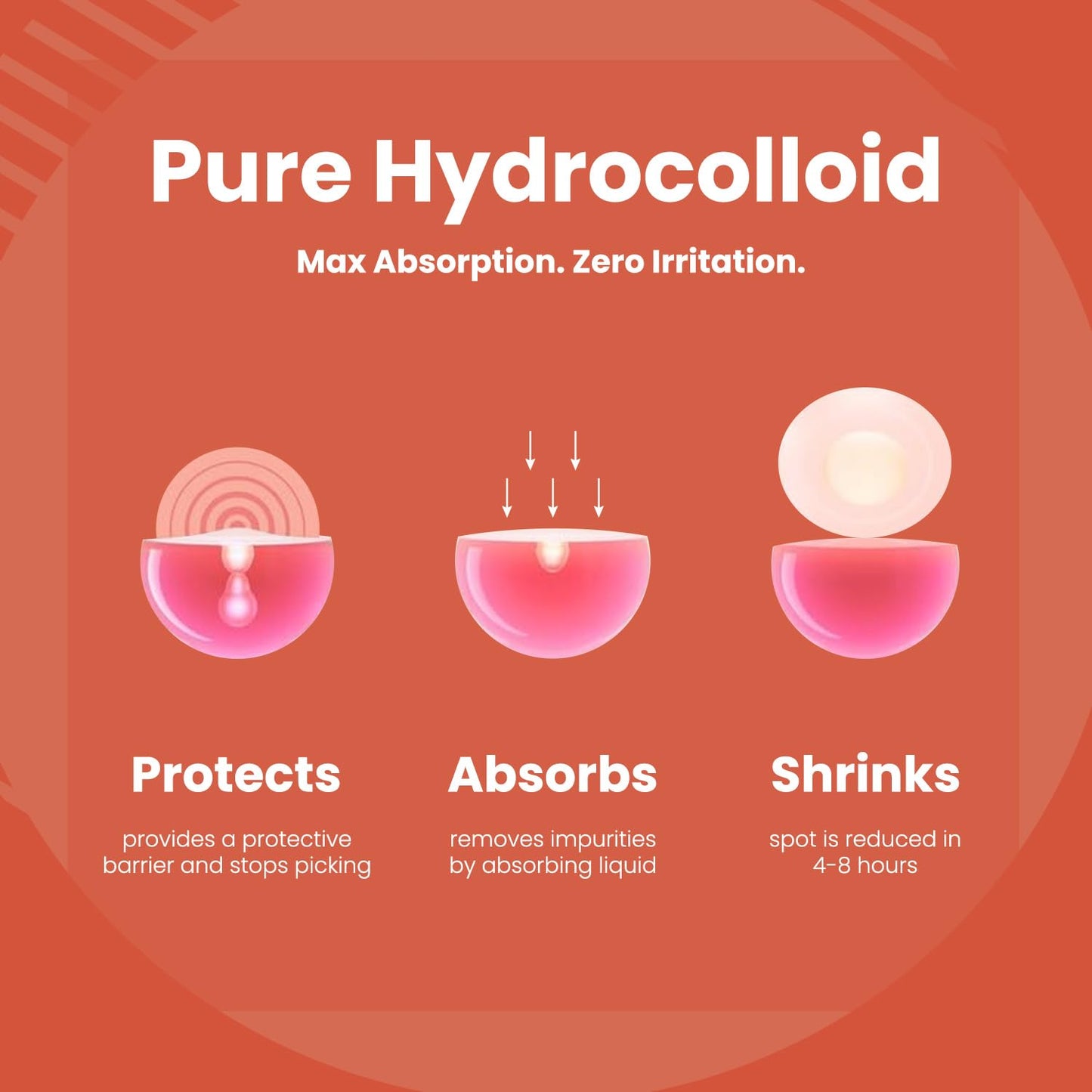 ROSELYNBOUTIQUE Pimple Patches - Hydrocolloid Spot Patches for Blemishes – 300 Clear Dots – Vegan & Cruelty-Free – Cosmetic Facial Skincare Product