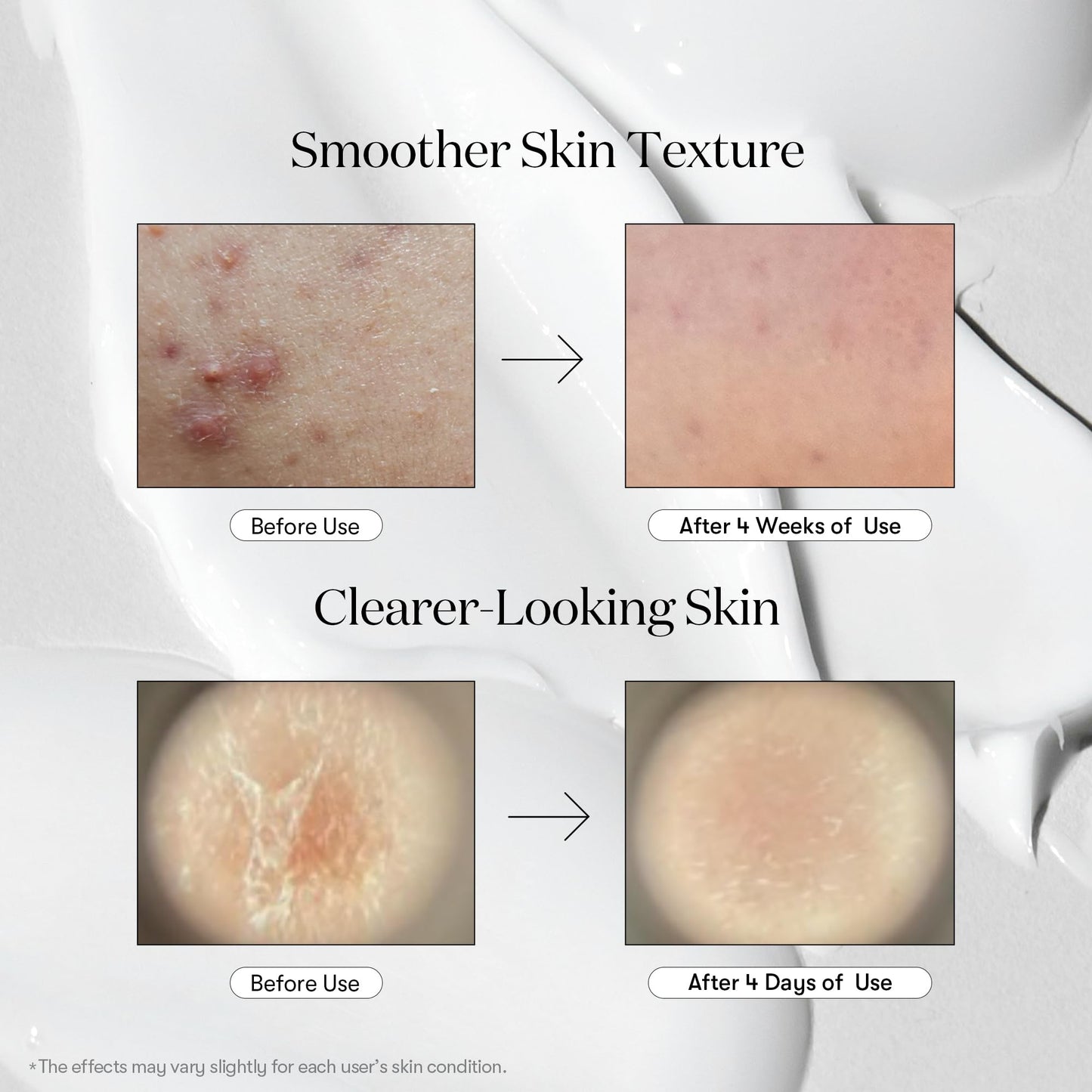 VT COSMETICS CICA Reedle Shot 100, Spicule Microneedling Serum for Pore Care & Exfoliation, Exosome, Centella Asiatica for Glass Skin, Skin Texture, Korean Liquid Skin Booster (1.69 Fl Oz / 50ml)