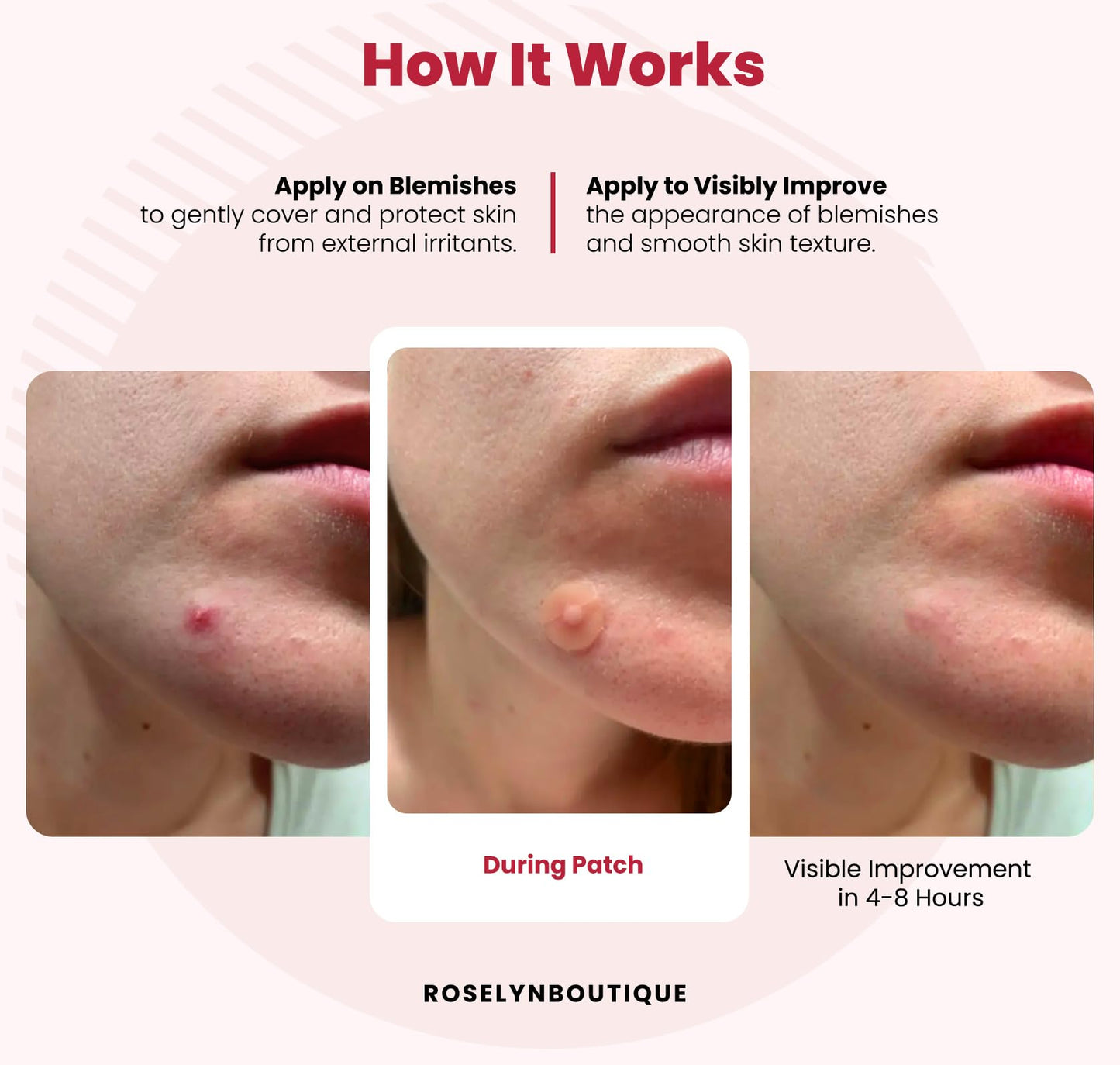 ROSELYNBOUTIQUE Pimple Patches - Hydrocolloid Spot Patches for Blemishes – 300 Clear Dots – Vegan & Cruelty-Free – Cosmetic Facial Skincare Product