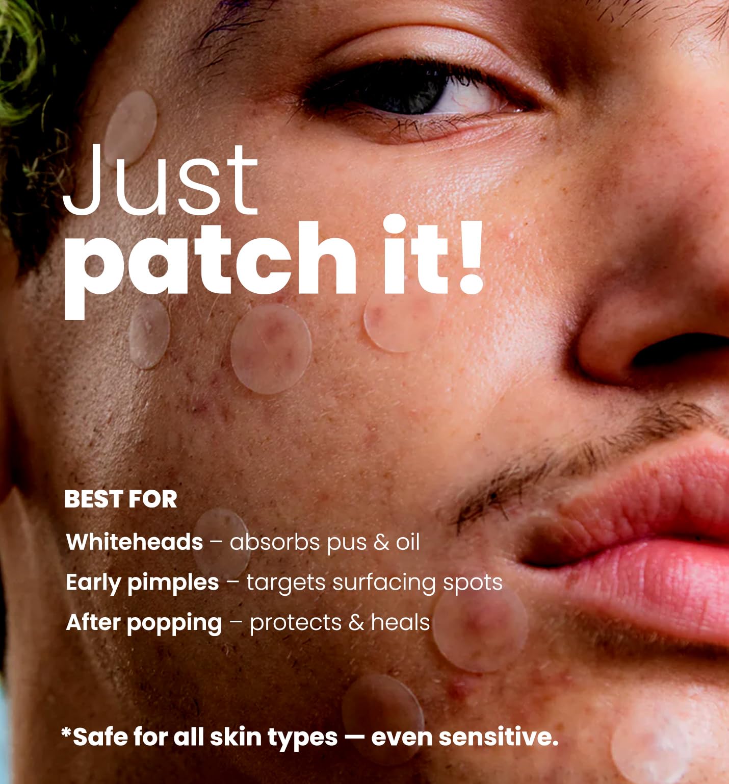 ROSELYNBOUTIQUE Pimple Patches - Hydrocolloid Spot Patches for Blemishes – 300 Clear Dots – Vegan & Cruelty-Free – Cosmetic Facial Skincare Product