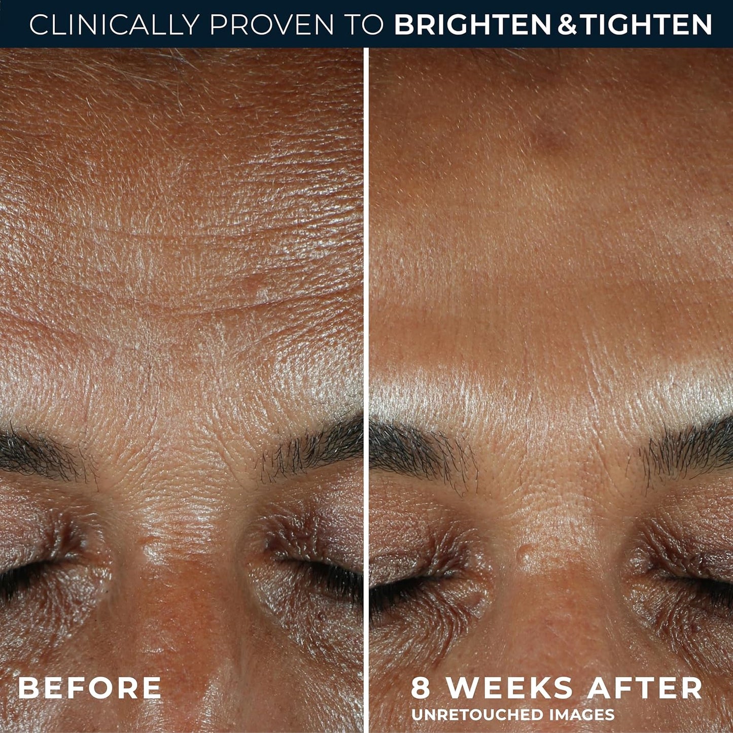 RoC Multi Correxion Revive + Glow Daily Serum | With 10% Vitamin C, Skincare for Face & Neck | 30 ml